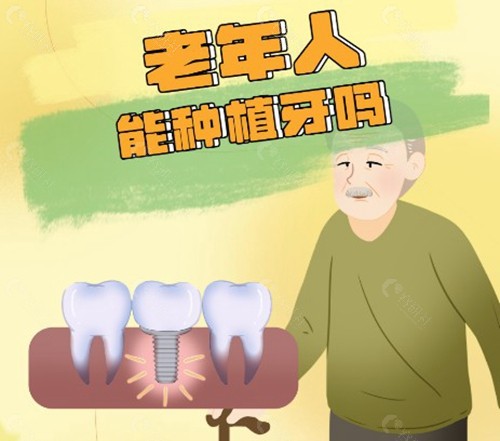 种植体费用：从“万元时代”迈入“千元时代”