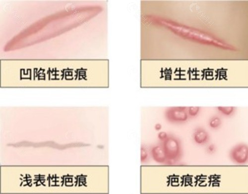 王喜梅医生