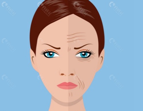 法令纹三点平移术是真的吗？