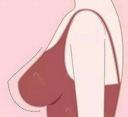 国内可开展铂蕴假体隆胸手术的医院推荐