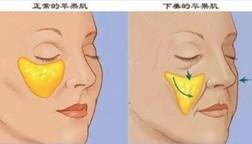 蹇洪医生