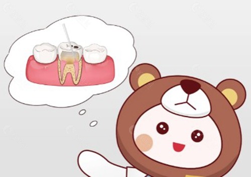 根管治疗过的牙齿使用寿命