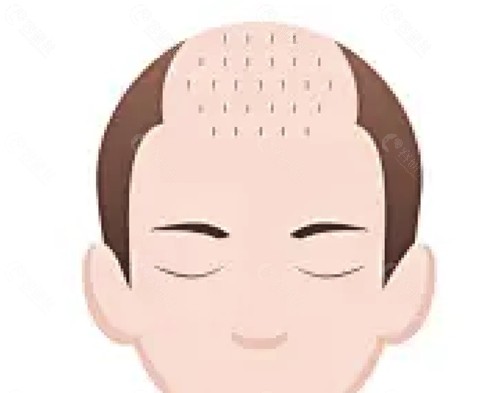 石家庄瑞丽诗治疗脱发好吗
