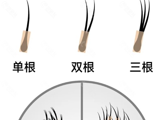 襄阳韩美植发怎么样