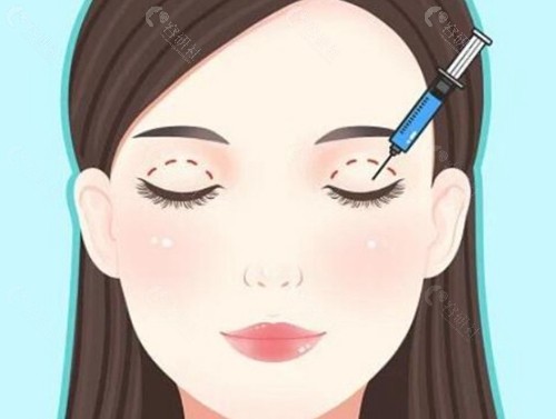 张芳医生