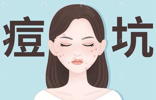 ADM填充后半月突起到底会不会消？
