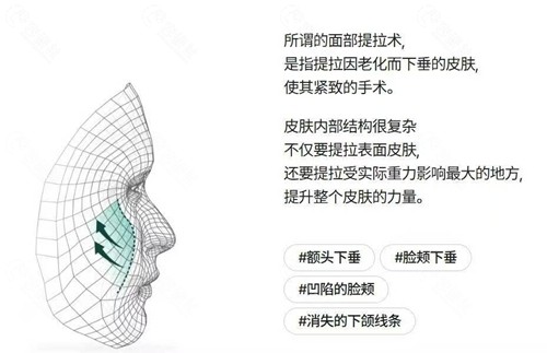 韩国丽婷医院面部提升怎么样？