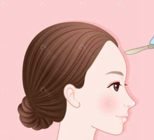 不同方法的技术特点与操作流程 不同方法的技术特点与操作流程