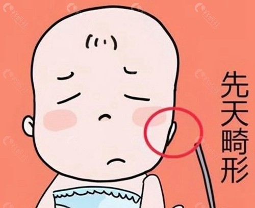 先天性耳朵畸形做手术我国有免费治疗政策吗？