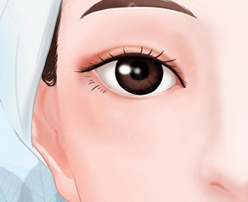 双眼皮修复几次就不能再做了？