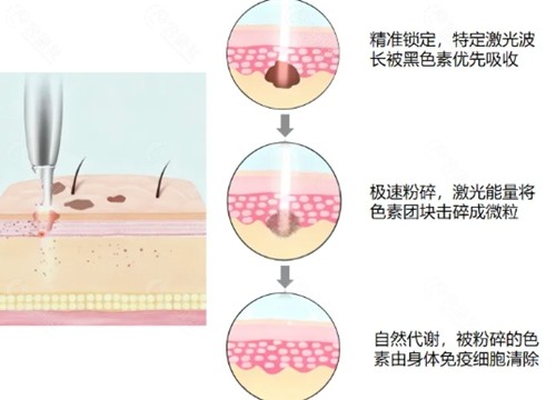 淮安施尔美医疗美容祛斑好吗