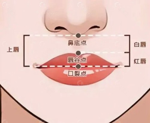 鼻基底下缩短法和上唇切开式一样吗