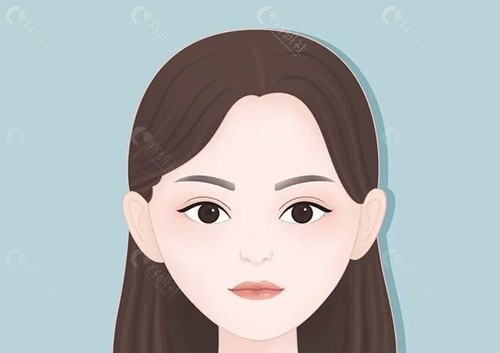 卢小生做双眼皮好吗