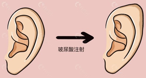 蒋铮铮医生