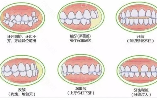 盐城精英口腔牙齿矫正好吗