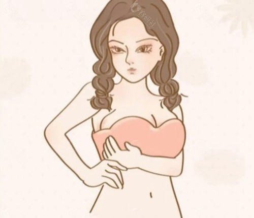 吸脂去副乳