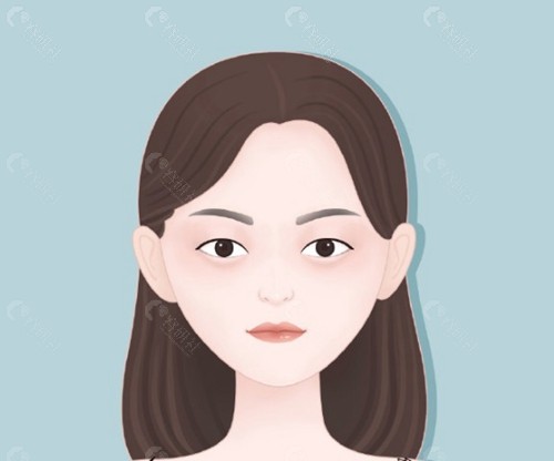 肿眼泡可以只抽脂不割双眼皮吗