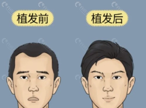 宜昌亚太植发好吗
