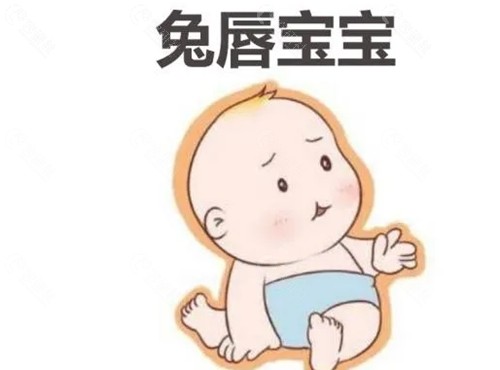 巫国辉 唇腭裂修复好吗