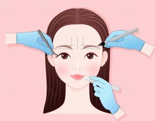 韩国眼部整形价格