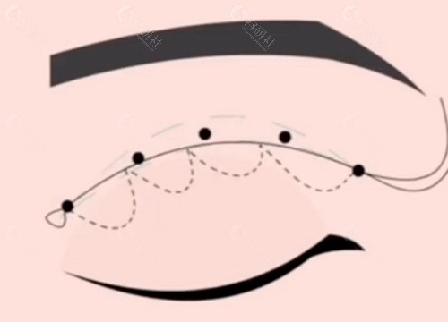 侯亚杰：韩系“电眼魔术师”