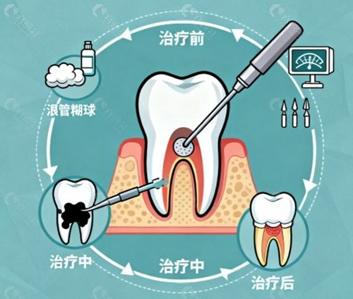 不同治疗方法及收费价格