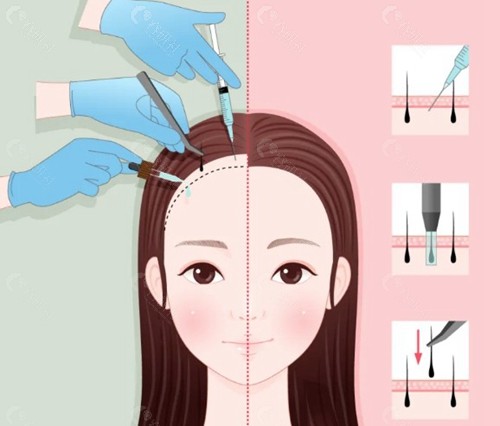 谢宝山：兼顾美学与性价比的实力医生