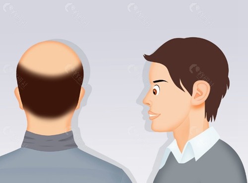 徐东辉：微创环境下的技术大牛