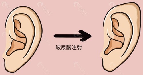 李大琦医生