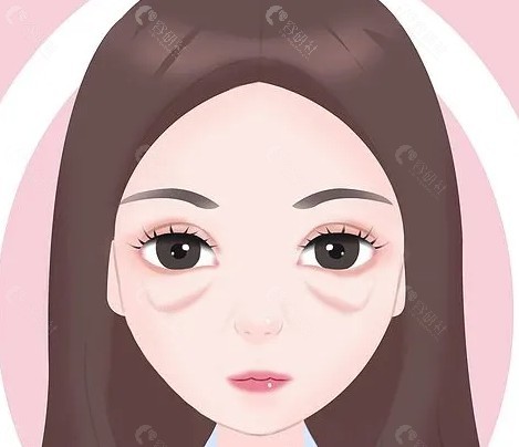 选择填充材料的考虑因素