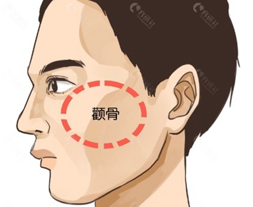 不同手术方法的收费价格