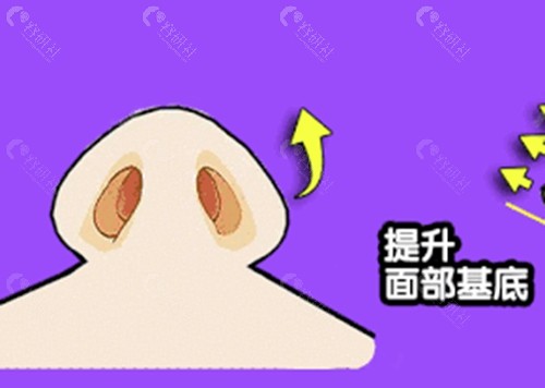 梁青松鼻部整形怎么样