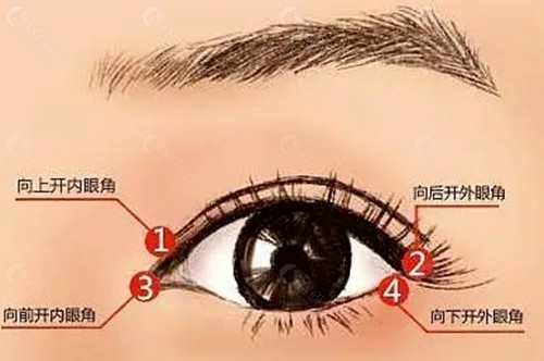 孟松开眼角手术怎么样