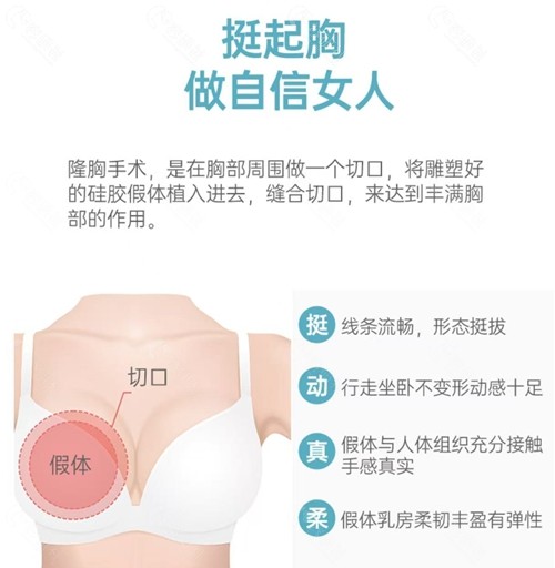 韩国普罗菲耳整形外科医院代表院长郑在皓丰胸技术怎么样？