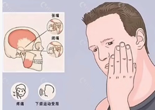 上下颚骨咬合错位矫正价格