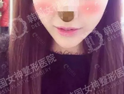 韩国女神医院