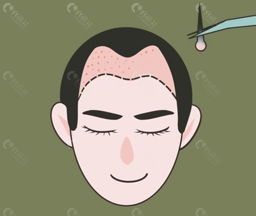 头发加密不同单位的价格情况