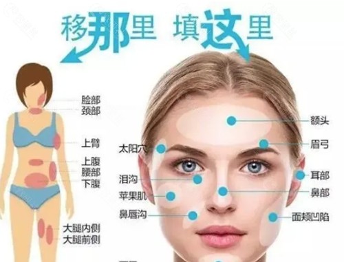 宋华敬做面部脂肪填充好吗 宋华敬做面部脂肪填充好吗