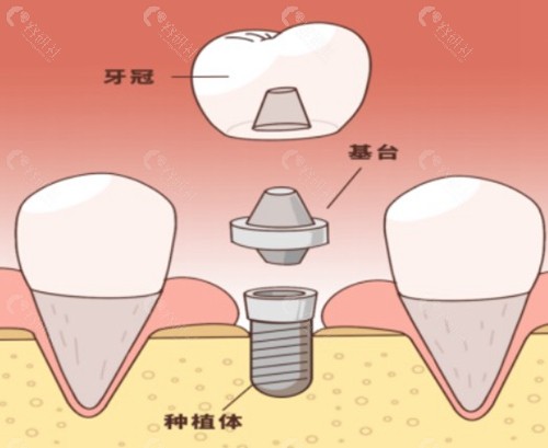 “劝退”背后的真相：医生的顾虑是什么？