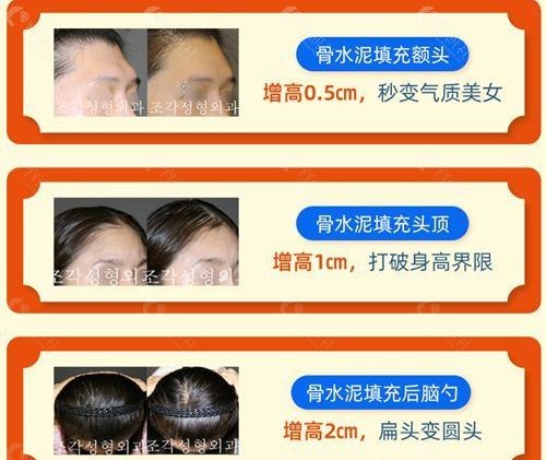 雕刻头像整形效果