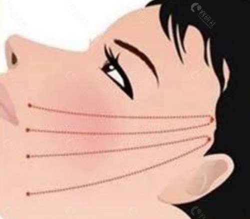韩国美迪线