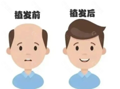 拉萨瑞俪植发怎么样