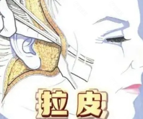 2026国内拉皮手术医生排名前10名单