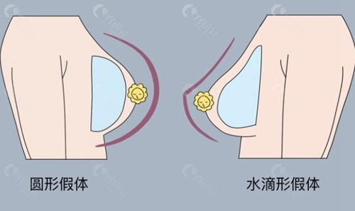 现在取出来对胸部伤害大不大？