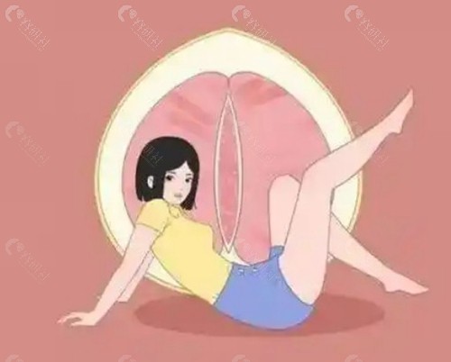 传统阴道紧缩术好还是3D生物束带紧缩术好？