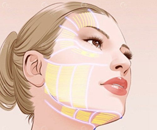 2026面部提升三件套十大医生排名