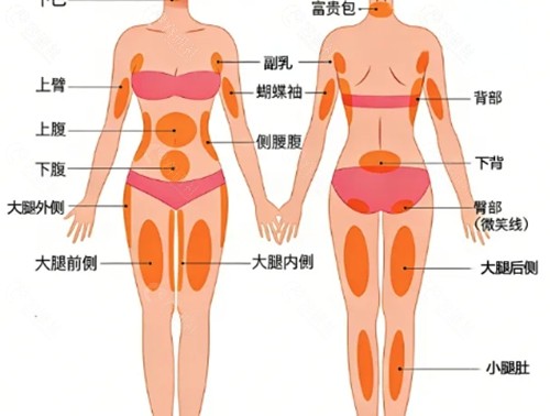 邓晟华吸脂好吗