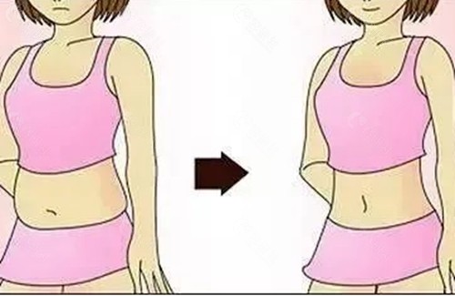 陈元良吸脂好吗