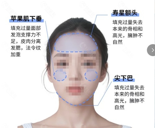 钟杰光馒化脸修复好吗