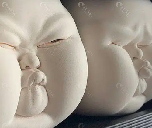 王世虎馒化脸修复好吗